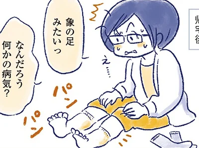子宮筋腫を乗り越えたのに…。52歳、立っていられないほどの足のむくみに直面して／私の生理のしまい方（7）