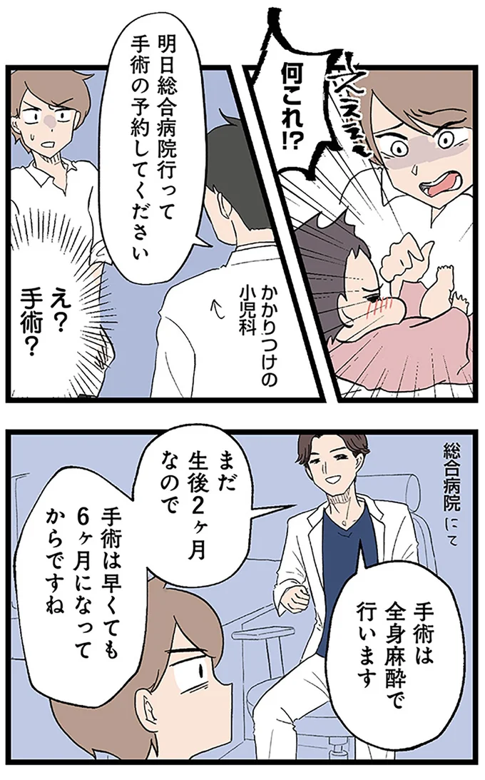 え?手術?