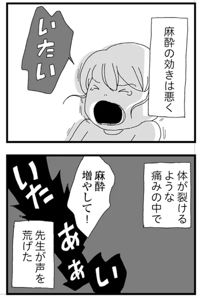 麻酔の効きは悪く