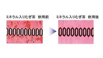 血流が改善されたことが分かる