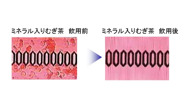 血流が改善されたことが分かる