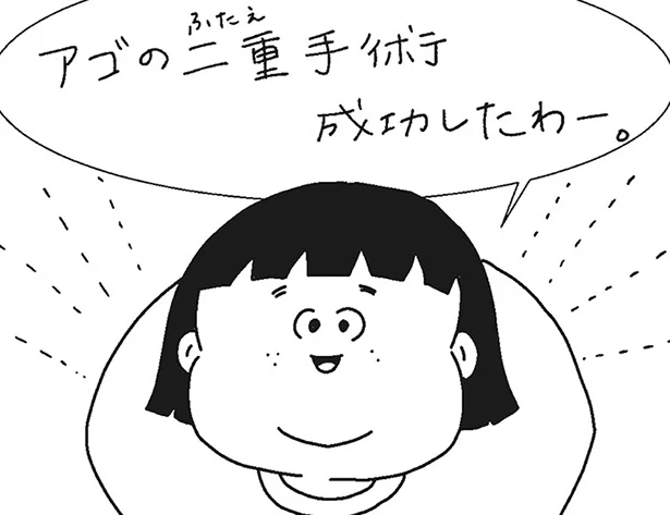 失敗じゃねぇし…！ 麻酔いらずの整形成功　ぽっちゃり姉妹のデブカワコメディ(3)【連載】
