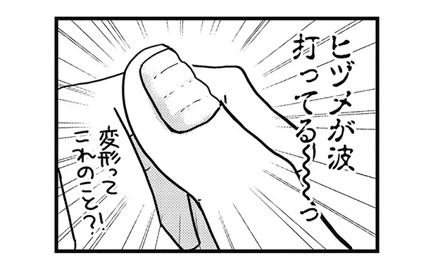 これも抗がん剤の影響!?