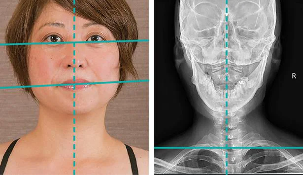 顔に左右差があるのは首のねじれやゆがみのせい 鏡に向かって首の状態をチェックしよう レタスクラブ
