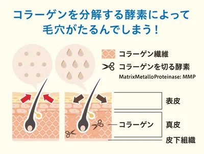 コラーゲンを分解する酵素によって毛穴がたるんでしまう！