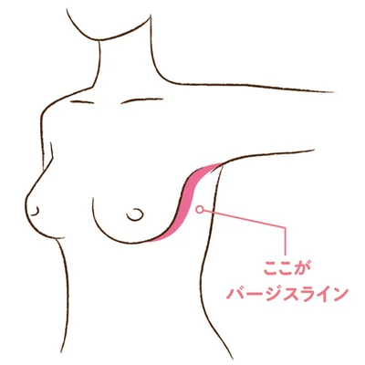 さらに！　バージスラインが消えてしまう