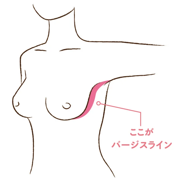 さらに！　バージスラインが消えてしまう