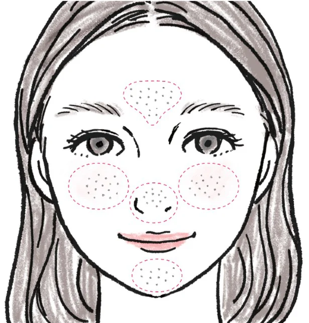 【画像】目立つ毛穴のタイプと場所とは!?