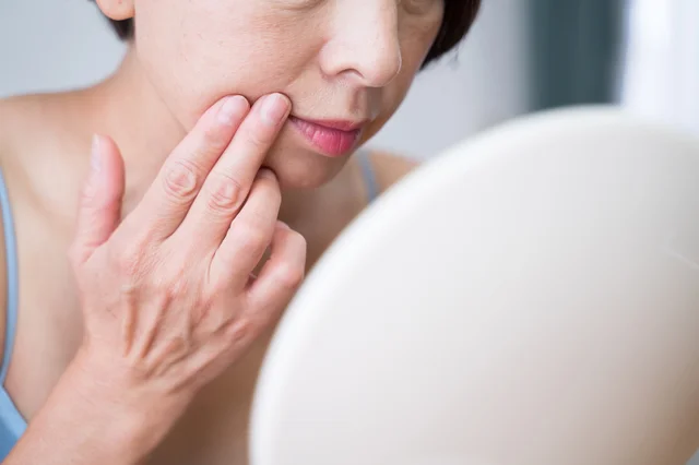 鏡を見るたびにうんざり…シミをレーザーでとることを夫に反対されています【お悩み相談】