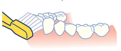 歯と歯ぐきの間が空いている場合、歯ぐきをマッサージする方法もあり。