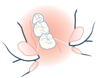 フロスは、歯ぐきを傷つけないよう ゆっくりと歯間に！
