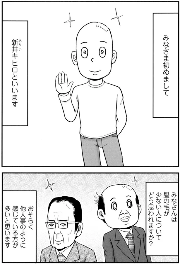 【全画像を見る】僕は髪の毛が少ない