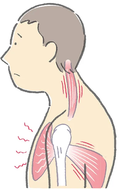 【画像を見る】首こりや肩こりの原因＝トリガーポイントを押す？