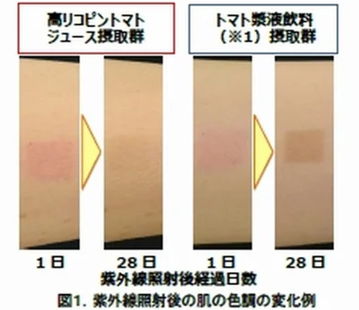 【写真を見る】トマトジュースの有無で肌の色の回復がこんなに違った